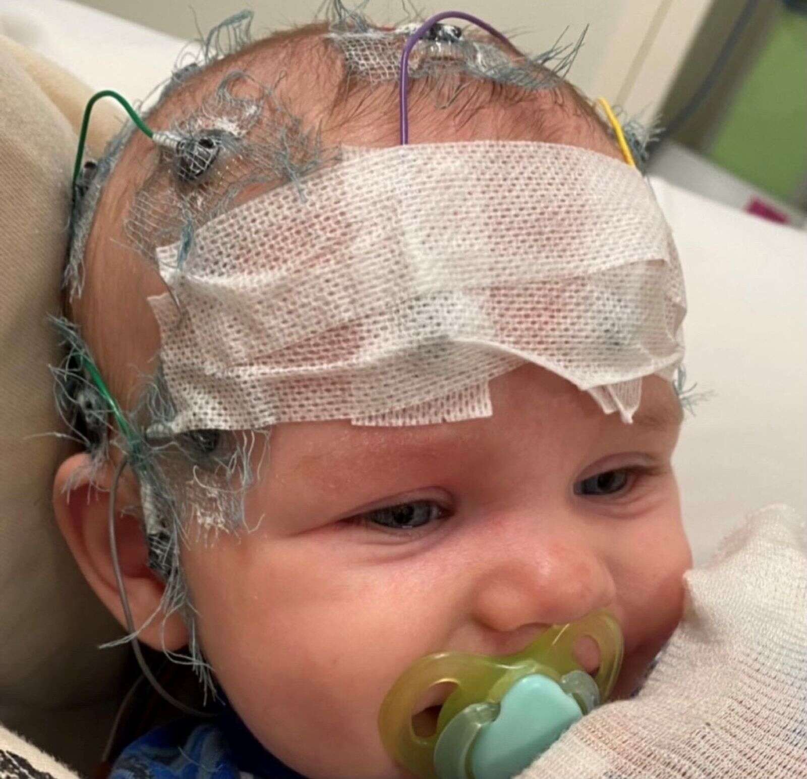 Brave boy to undergo brain surgery | Riverine Herald
