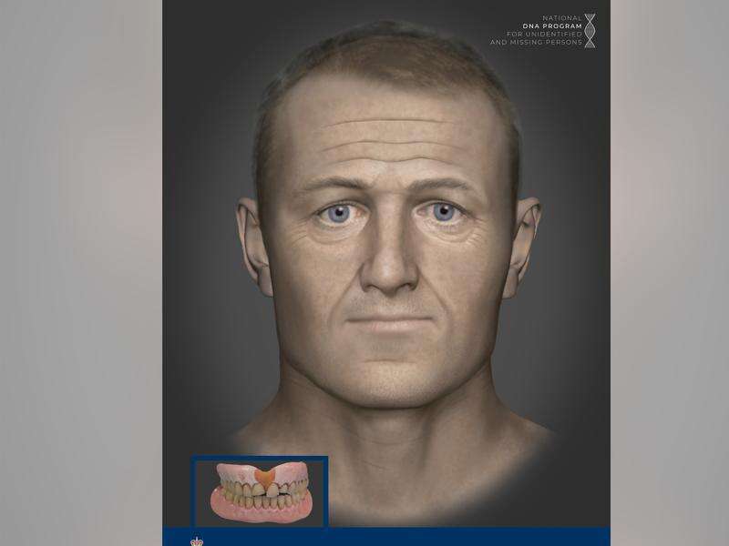 Breakthrough in mystery of 40-year-old set of bones | Kyabram Free Press