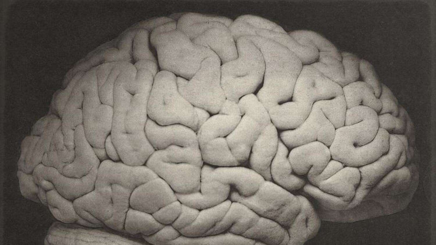 Large brain. Огромные мозги человека.