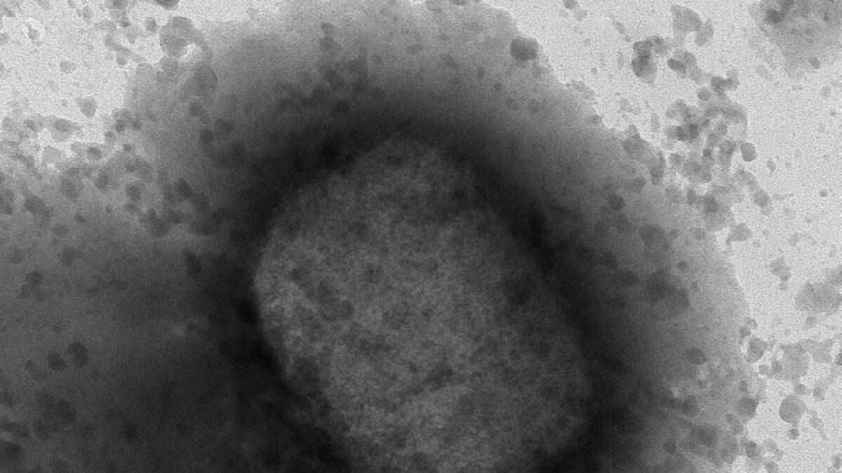 Electronic microscope image of the monkeypox virus