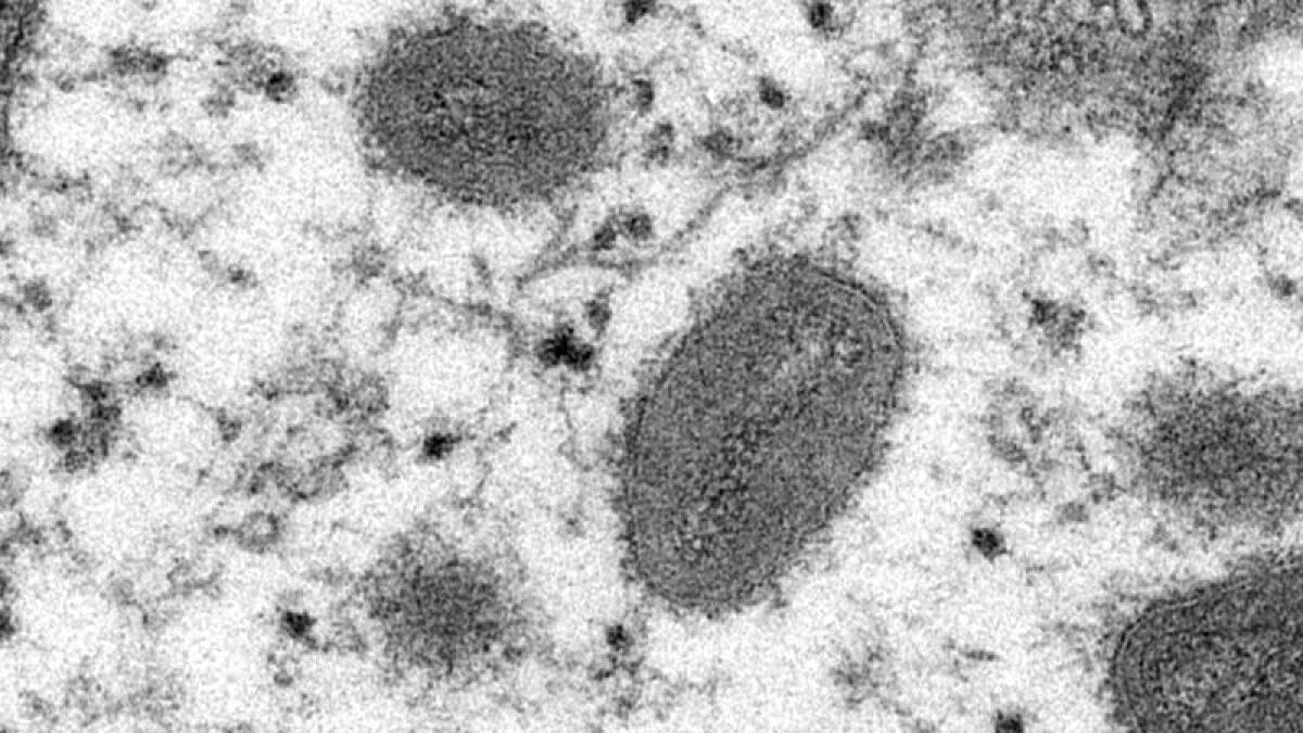 Electron microscope image shows oval-shaped monkeypox virions